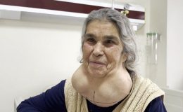 Denizli’de doktor korkusu yüzünden yıllarca devasa kitleyle yaşadı
