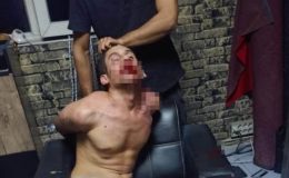 Şanlıurfalı gence akılalmaz işkence: Böcek yedirdiler, kerpetenle dişlerini söktüler